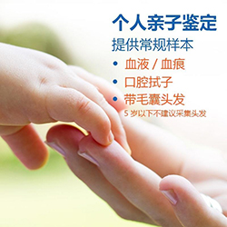 眉山隐私亲子鉴定准确率高吗[免费咨询]